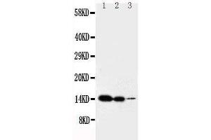 Image no. 1 for anti-Interleukin 2 (IL2) (AA 151-169), (C-Term) antibody (ABIN3043201)