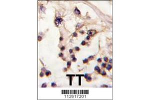 Image no. 2 for anti-Testis-Specific Kinase 2 (TESK2) (Center) antibody (ABIN2504569)