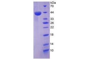 Image no. 1 for Chemokine (C-X-C Motif) Ligand 12 (CXCL12) (AA 23-89) (Active) protein (His tag,GST tag) (ABIN6239854)