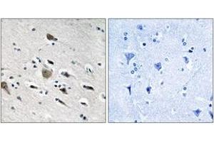 anti-Mitochondrial Ribosomal Protein L52 (MRPL52) (AA 71-120) antibody