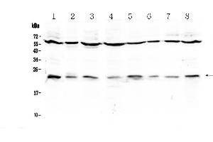 Image no. 1 for anti-Interleukin 1 Receptor Antagonist (IL1RN) (AA 26-177) antibody (ABIN5518923)