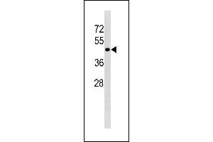 Image no. 2 for anti-Transforming Growth Factor, beta Receptor 1 (TGFBR1) (AA 145-172) antibody (ABIN1881880)
