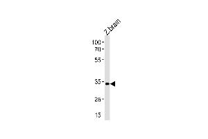 Image no. 1 for anti-Paired Box Gene 2a (PAX2A) (AA 258-284) antibody (ABIN1881634)