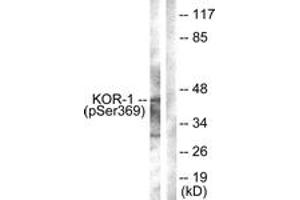 Western blot analysis of extracts from NIH-3T3 cells, using KOR-1 (Phospho-Ser369) Antibody.