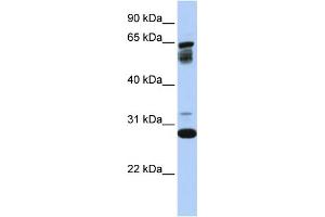 Image no. 2 for anti-Transmembrane Protein 187 (TMEM187) (Middle Region) antibody (ABIN2782233)
