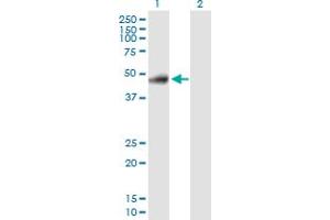 Image no. 4 for anti-RELT Tumor Necrosis Factor Receptor (RELT) (AA 1-430) antibody (ABIN529851)