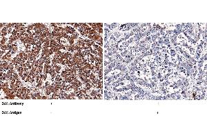 Image no. 2 for anti-Neuroblastoma 1, DAN Family BMP Antagonist (NBL1) (AA 1-180) antibody (ABIN1995901)