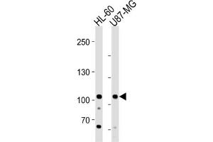 Image no. 1 for anti-MORC Family CW-Type Zinc Finger 3 (MORC3) antibody (ABIN3004591)