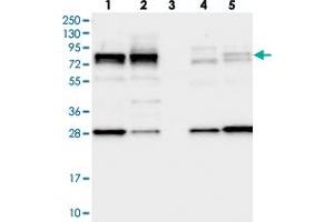 Image no. 2 for anti-Large Subunit GTPase 1 Homolog (Lsg1) antibody (ABIN5582778)