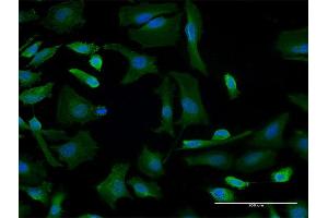 Immunofluorescence of monoclonal antibody to GBF1 on HeLa cell.