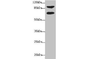 Western blot All lanes: DTX2 antibody at 1 μg/mL + HepG2 whole cell lysate Secondary Goat polyclonal to rabbit IgG at 1/10000 dilution Predicted band size: 68, 63 kDa Observed band size: 68, 92 kDa