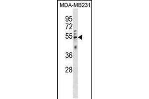 Image no. 1 for anti-HtrA Serine Peptidase 4 (HTRA4) (AA 283-311) antibody (ABIN5533070)