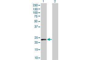 Image no. 1 for anti-Sorting Nexin 12 (SNX12) (AA 1-172) antibody (ABIN526169)