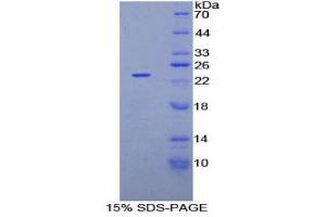 Image no. 1 for NME/NM23 Nucleoside Diphosphate Kinase 3 (NME3) (AA 1-168) protein (His tag) (ABIN1878101)