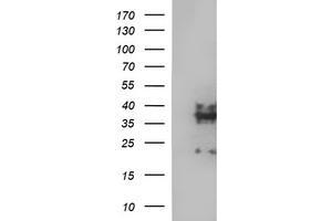 Image no. 4 for anti-Synaptophysin (SYP) antibody (ABIN1501259)