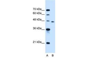 Image no. 1 for anti-Solute Carrier Family 16, Member 12 (Monocarboxylic Acid Transporter 12) (SLC16A12) (AA 49-98) antibody (ABIN6736666)