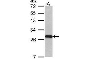 Image no. 1 for anti-Myosin, Light Chain 3 (MYL3) (Center) antibody (ABIN2855521)