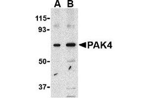 Image no. 1 for anti-P21-Activated Kinase 4 (PAK4) (Middle Region) antibody (ABIN1031030)