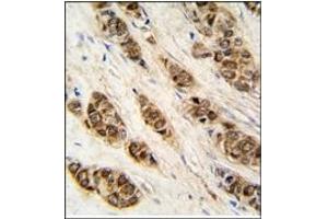 Image no. 2 for anti-DCTP Pyrophosphatase 1 (DCTPP1) (N-Term) antibody (ABIN357989)