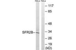Image no. 1 for anti-serine/arginine-Rich Splicing Factor 8 (SRSF8) (AA 31-80) antibody (ABIN1535396)