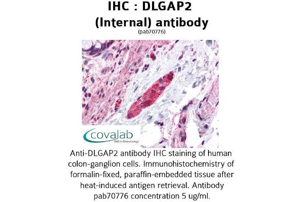 DLGAP2 抗体  (Internal Region)