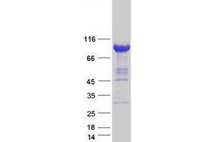Image no. 1 for Zw10 Kinetochore Protein (ZW10) protein (Myc-DYKDDDDK Tag) (ABIN2736189)