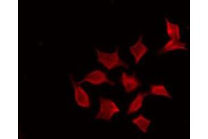 Image no. 2 for anti-Prefoldin Subunit 1 (PFDN1) (Internal Region) antibody (ABIN6257796)