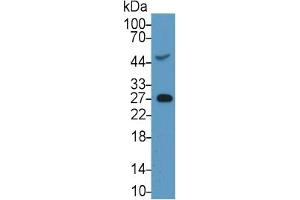 Image no. 5 for C-Reactive Protein (CRP) ELISA Kit (ABIN6574221)