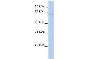 Image no. 1 for anti-SRY (Sex Determining Region Y)-Box 30 (SOX30) (Middle Region) antibody (ABIN2777696)
