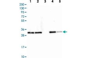 Image no. 1 for anti-Clathrin, Light Chain A (CLTA) antibody (ABIN5575618)