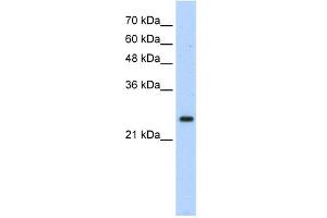 Image no. 3 for anti-Homeobox B7 (HOXB7) (C-Term) antibody (ABIN2775771)