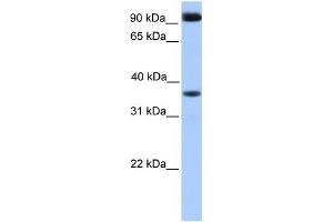 Image no. 1 for anti-DCN1, Defective in Cullin Neddylation 1, Domain Containing 4 (DCUN1D4) (Middle Region) antibody (ABIN2785748)