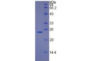 Image no. 5 for Retinol Binding Protein 4, Plasma (RBP4) ELISA Kit (ABIN6574239)