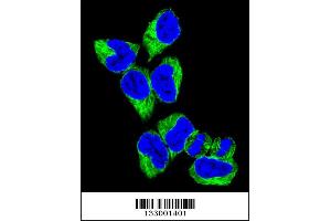 Image no. 1 for anti-GNAS Complex Locus (GNAS) (AA 287-315), (C-Term) antibody (ABIN656989)