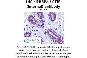 Image no. 1 for anti-Retinoblastoma Binding Protein 8 (RBBP8) (Internal Region) antibody (ABIN1738768)