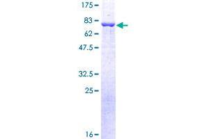 Image no. 1 for Arrestin, beta 2 (ARRB2) (AA 1-409) protein (GST tag) (ABIN1345726)