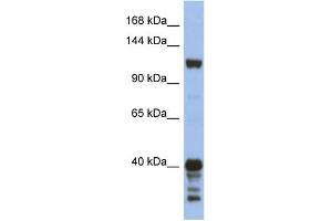 Image no. 1 for anti-Signal-Induced Proliferation-Associated 1 (SIPA1) (Middle Region) antibody (ABIN2787827)