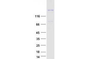 Image no. 1 for ADAM Metallopeptidase with Thrombospondin Type 1 Motif, 13 (ADAMTS13) (Transcript Variant 1) protein (Myc-DYKDDDDK Tag) (ABIN2714385)