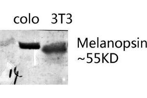 Image no. 2 for anti-Opsin 4 (OPN4) (C-Term) antibody (ABIN3185538)