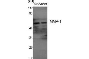 Image no. 3 for anti-Matrix Metallopeptidase 1 (Interstitial Collagenase) (MMP1) (C-Term) antibody (ABIN3185593)