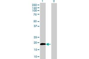 Western Blot analysis of CYB5B expression in transfected 293T cell line by CYB5B MaxPab polyclonal antibody.
