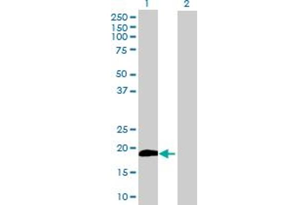 anti-Cytochrome B5 Type B (Outer Mitochondrial Membrane) (CYB5B) (AA 1-146) antibody