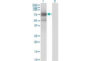 Image no. 2 for anti-BMX Non-Receptor Tyrosine Kinase (BMX) (AA 150-280) antibody (ABIN560085)