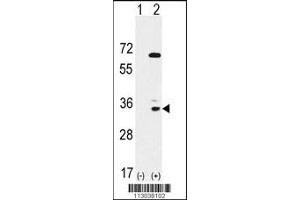 Western Blotting (WB) image for anti-EPH Receptor A10 (EPHA10) antibody (ABIN2158716)