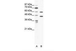Image no. 1 for anti-Cation Channel, Sperm Associated 2 (CATSPER2) (C-Term) antibody (ABIN203196)