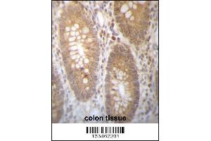 Immunohistochemistry (IHC) image for anti-Dehydrogenase/reductase (SDR Family) Member 7B (DHRS7B) (Center) antibody (ABIN2160583)