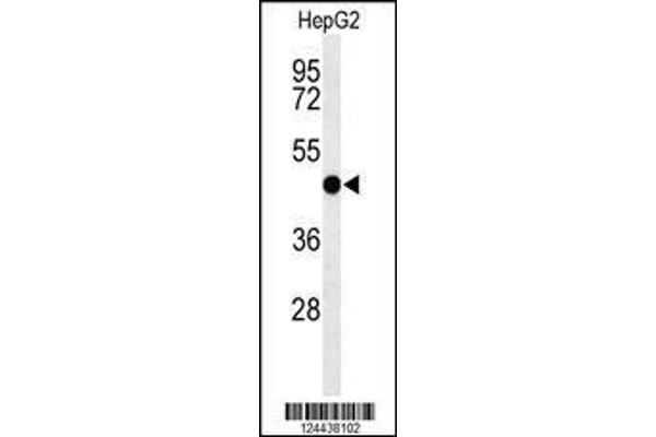 anti-Sphingomyelin Synthase 2 (SGMS2) (AA 338-365), (C-Term) antibody