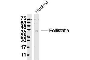 Image no. 1 for anti-Follistatin (FST) (AA 151-250) antibody (ABIN734258)