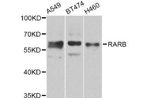 Image no. 2 for anti-Retinoic Acid Receptor, beta (RARB) antibody (ABIN2737447)