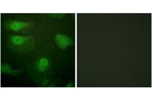 Immunofluorescence analysis of HeLa cells, using CaMK1-alpha (Phospho-Thr177) Antibody.